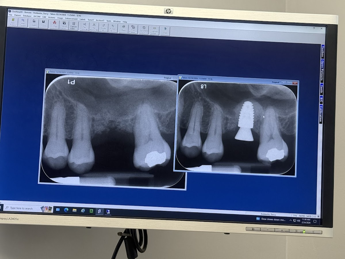 Periodontal Centers of Rochester photo 6