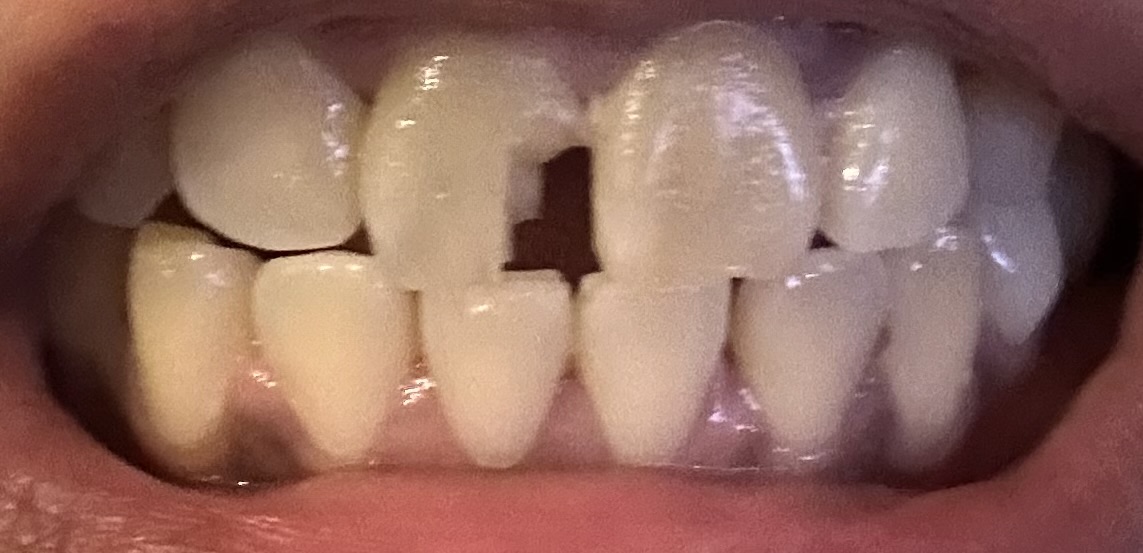 Dr. Syed Quadri, DMD | Palm Bay Dentist photo 4