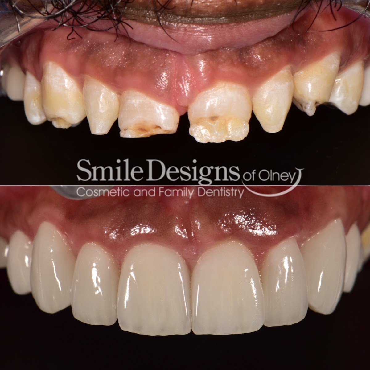 Smile Designs of Olney - Mitchell A. Lomke, DDS & Joshua M. Lomke, DDS photo 2
