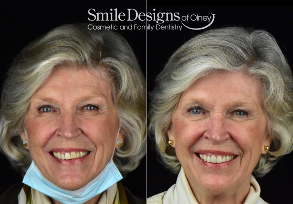 Smile Designs of Olney - Mitchell A. Lomke, DDS & Joshua M. Lomke, DDS photo 3