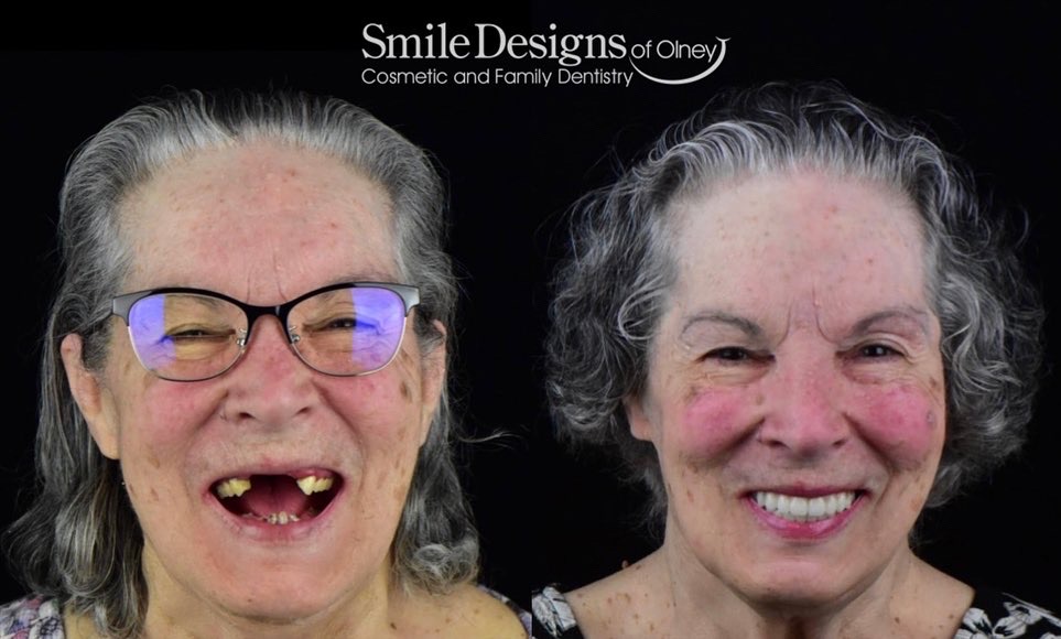 Smile Designs of Olney - Mitchell A. Lomke, DDS & Joshua M. Lomke, DDS photo 5