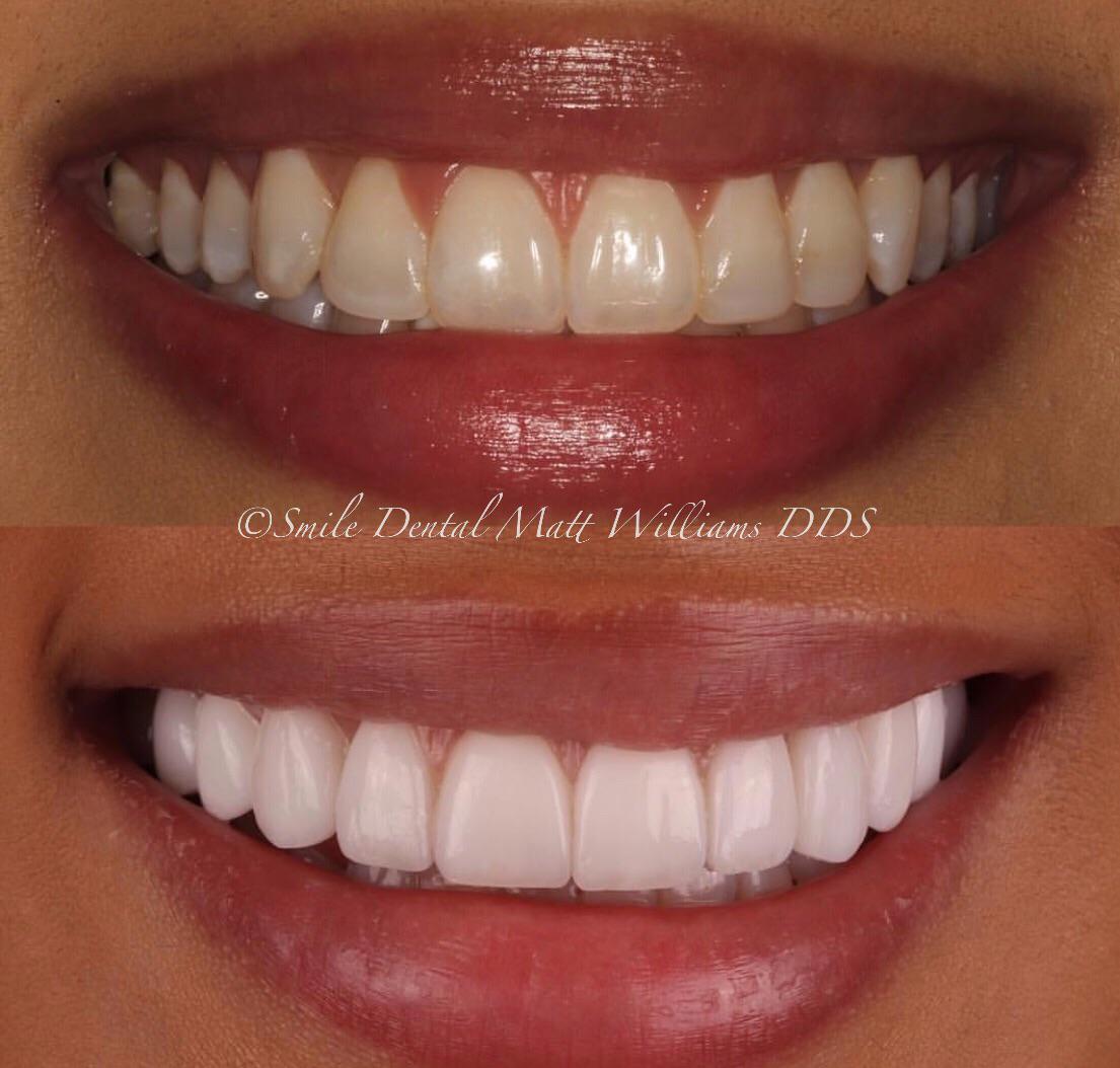 Smile Dental photo 3