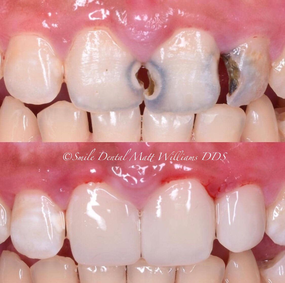 Smile Dental photo 5