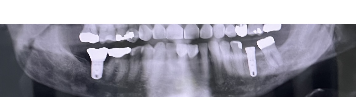 Jackson Oral Surgery: Walter C. Jackson, DDS, MD photo 4