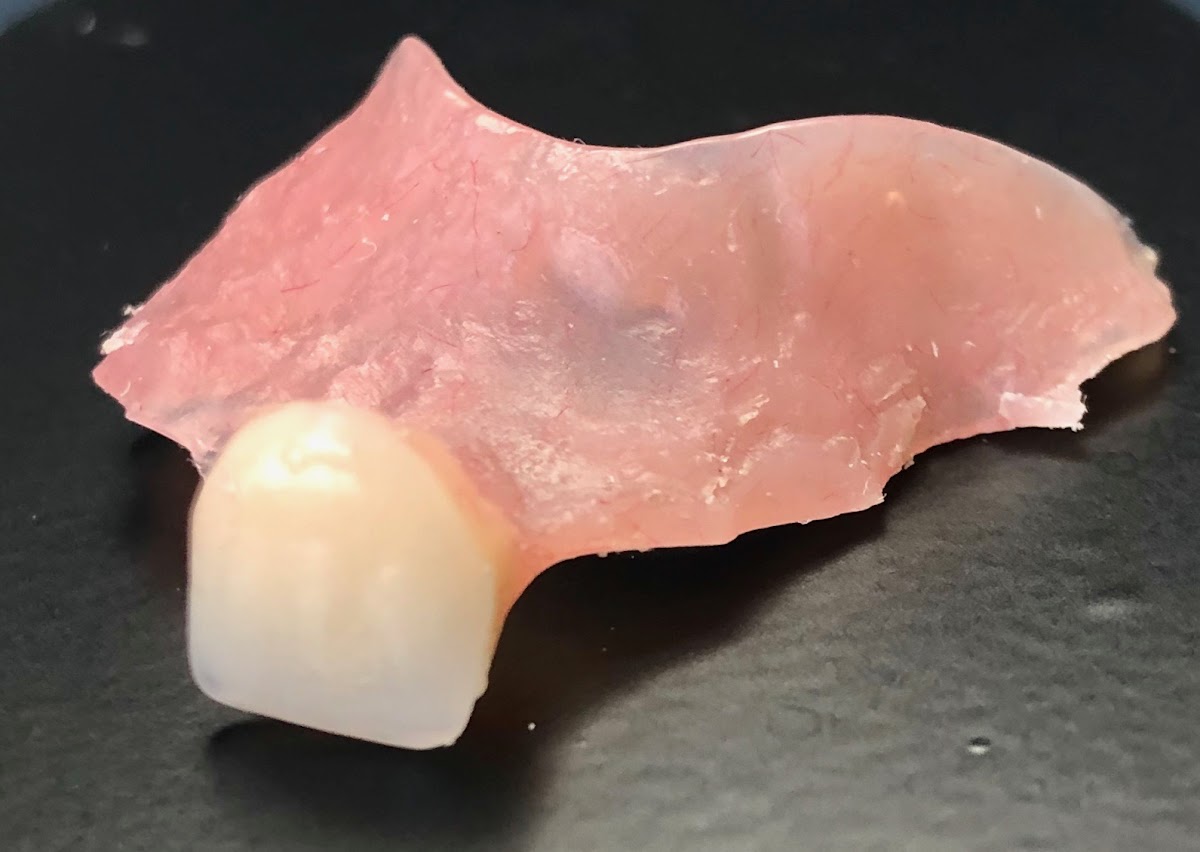 Implant Center of Coral Gables photo 6