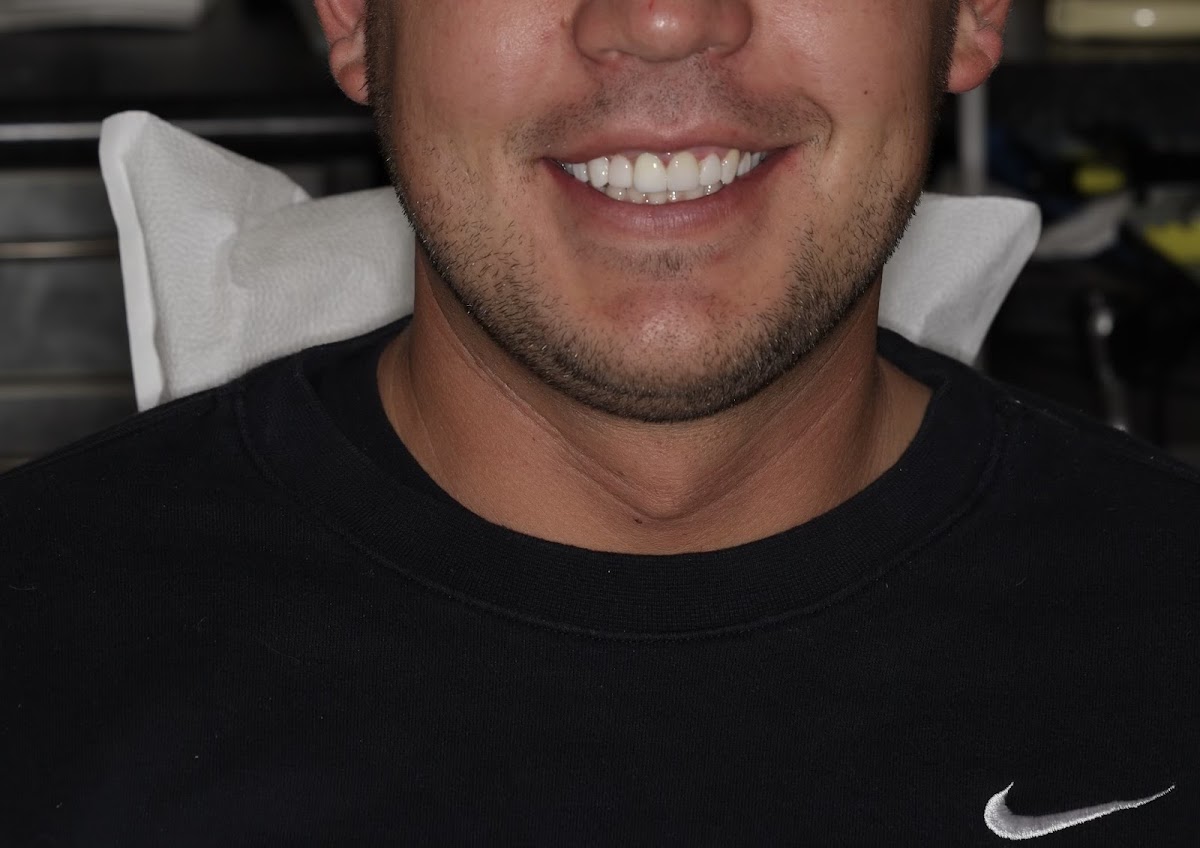 Allen Aesthetics: Family, Cosmetic and Implant Dentistry - Mark Allen DDS, Katie Allen DMD photo 2