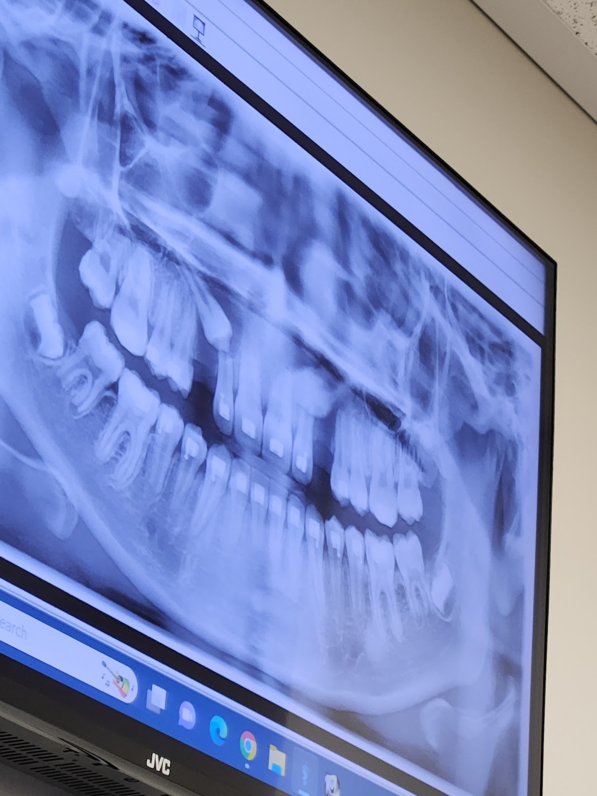 Oral & Maxillofacial Surgeons of Utah photo 2