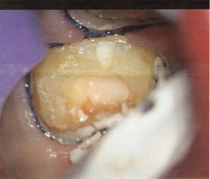 Aspen Dental - Sandusky photo 3