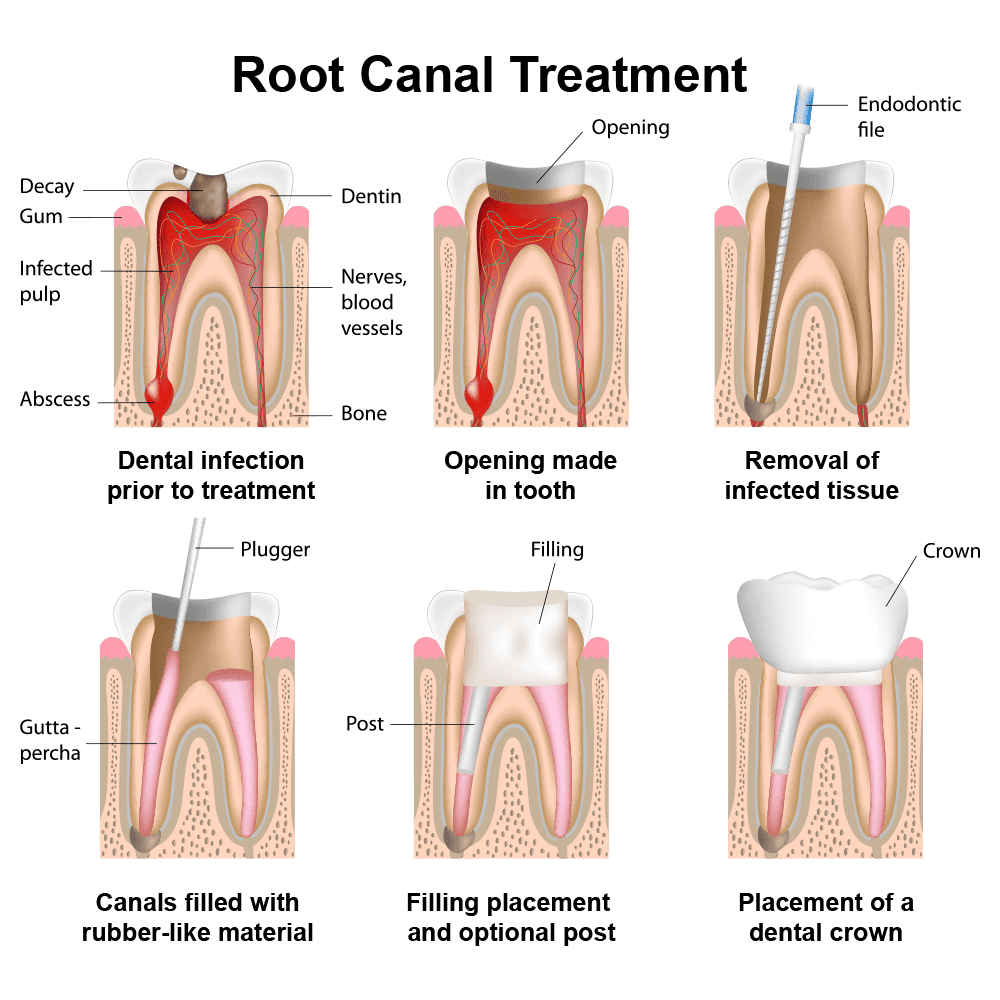 Apex Dental photo 5