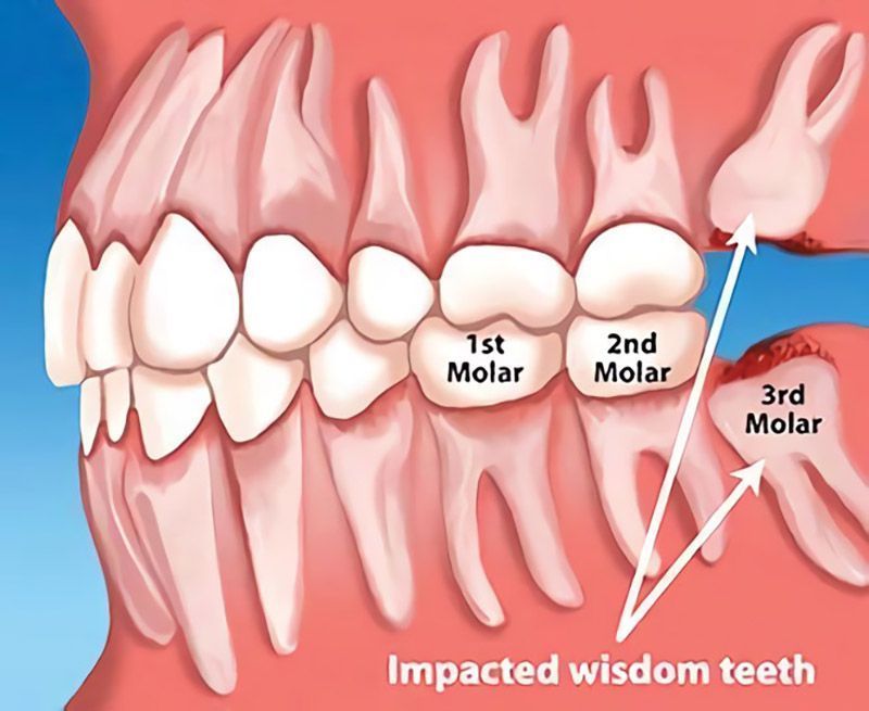 Apex Dental photo 6