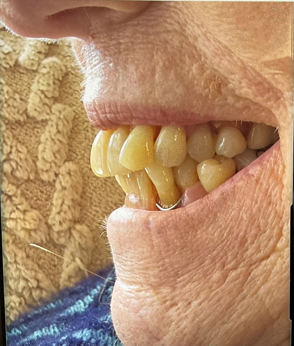 Aspen Dental - Christiansburg photo 1