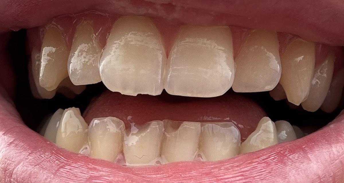 Walton Family, Cosmetic & Implant Dentistry photo 5