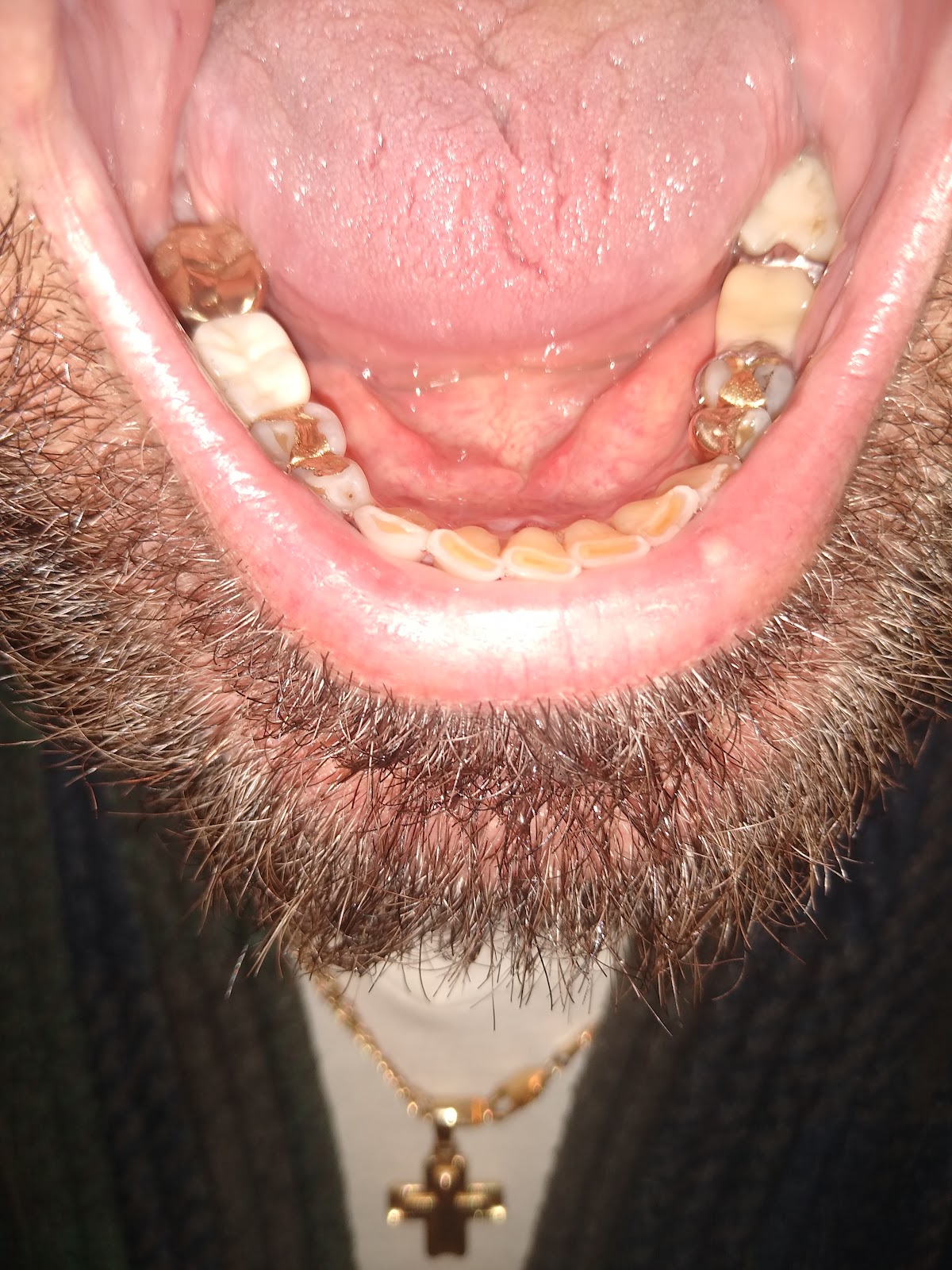 Alpine Dental photo 5