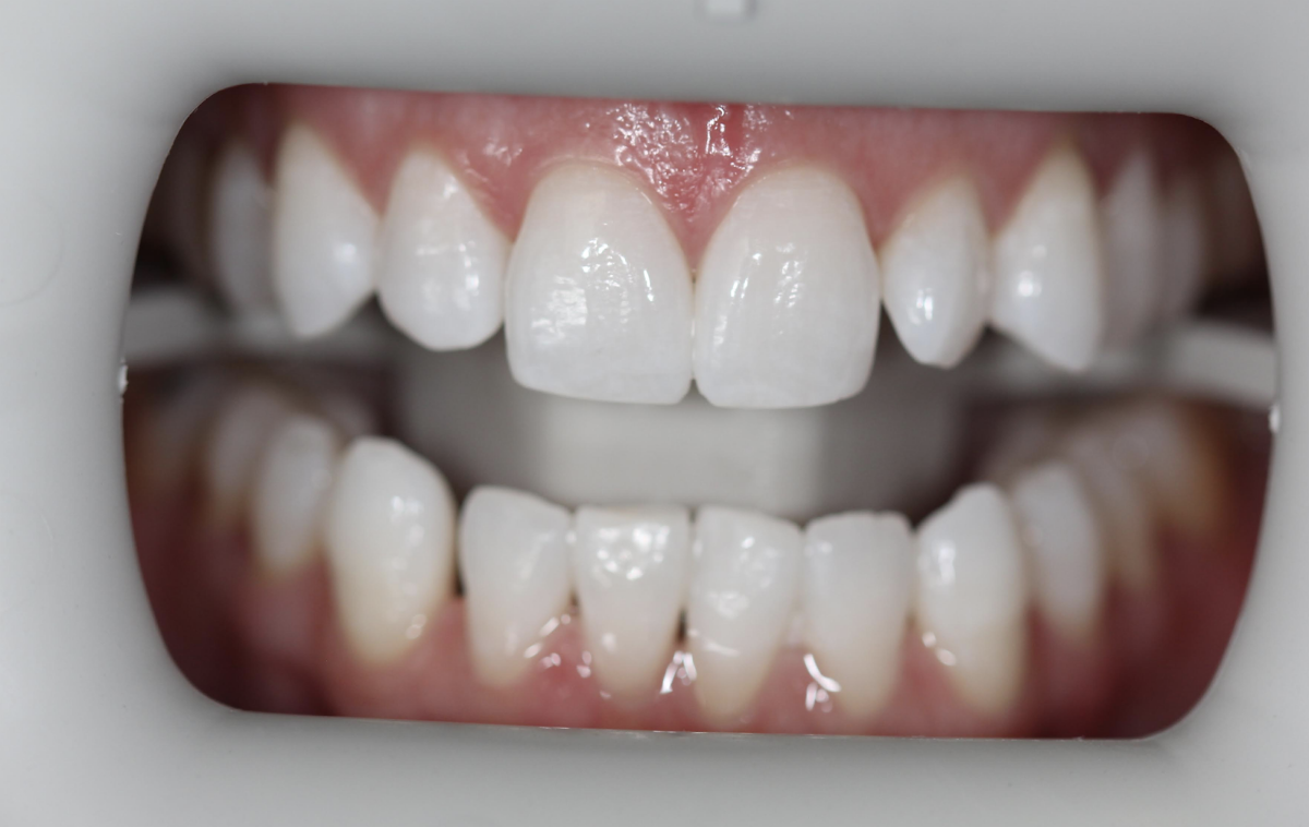 Coral West Dental photo 5