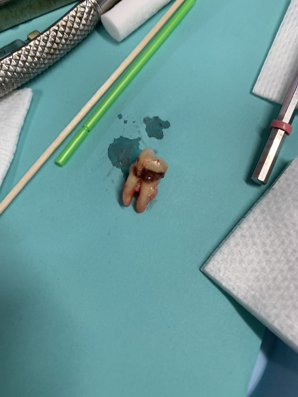 Coral West Dental photo 6