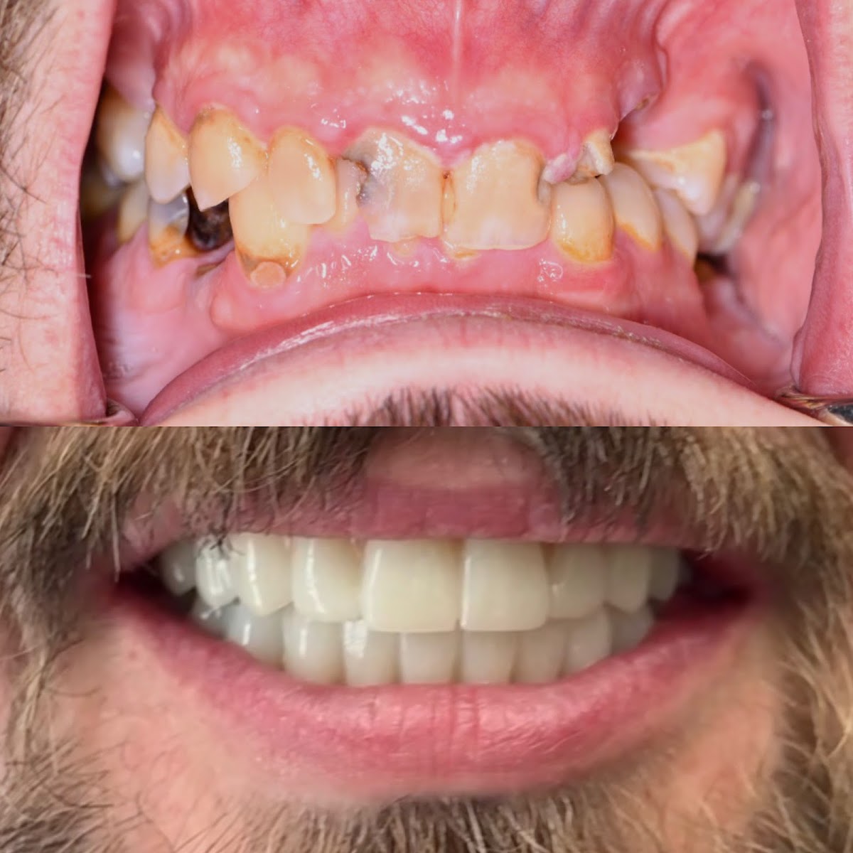 Smilecentric - General, Cosmetic & Implant Dentistry photo 2