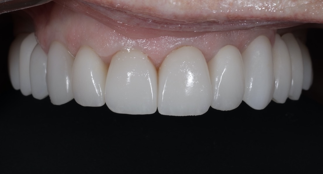 Signature Dental of Lawrence photo 2