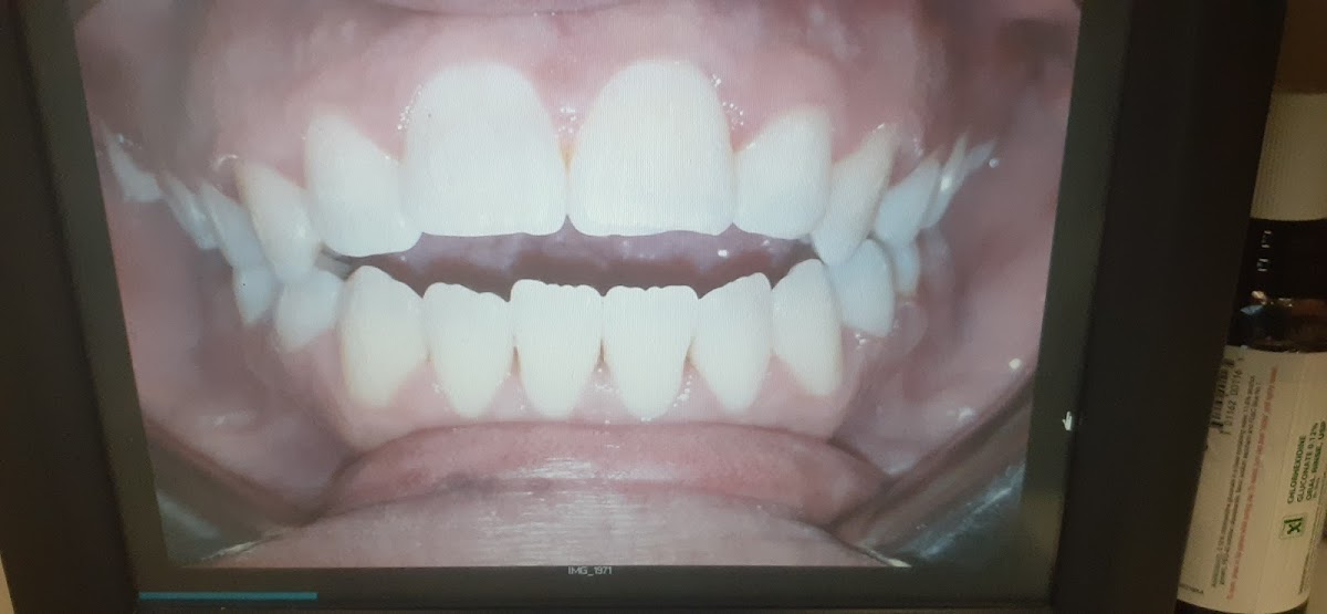 3rd Avenue Complete Family Dental photo 5
