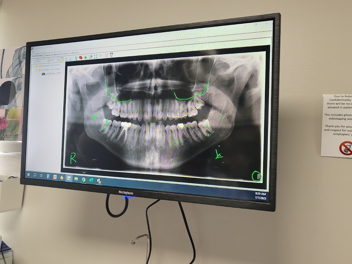 Michigan Oral Surgeons, Dental Implants & Wisdom Teeth photo 3