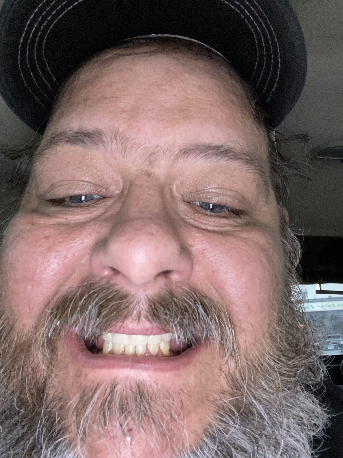 Affordable Dentures & Implants - Fairview Heights photo 6