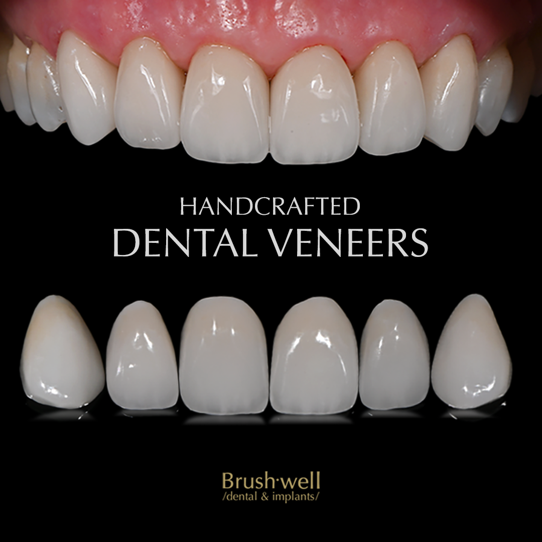 Brushwell Dental & Implants photo 1