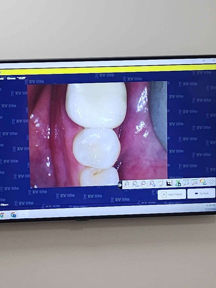Brushwell Dental & Implants photo 3
