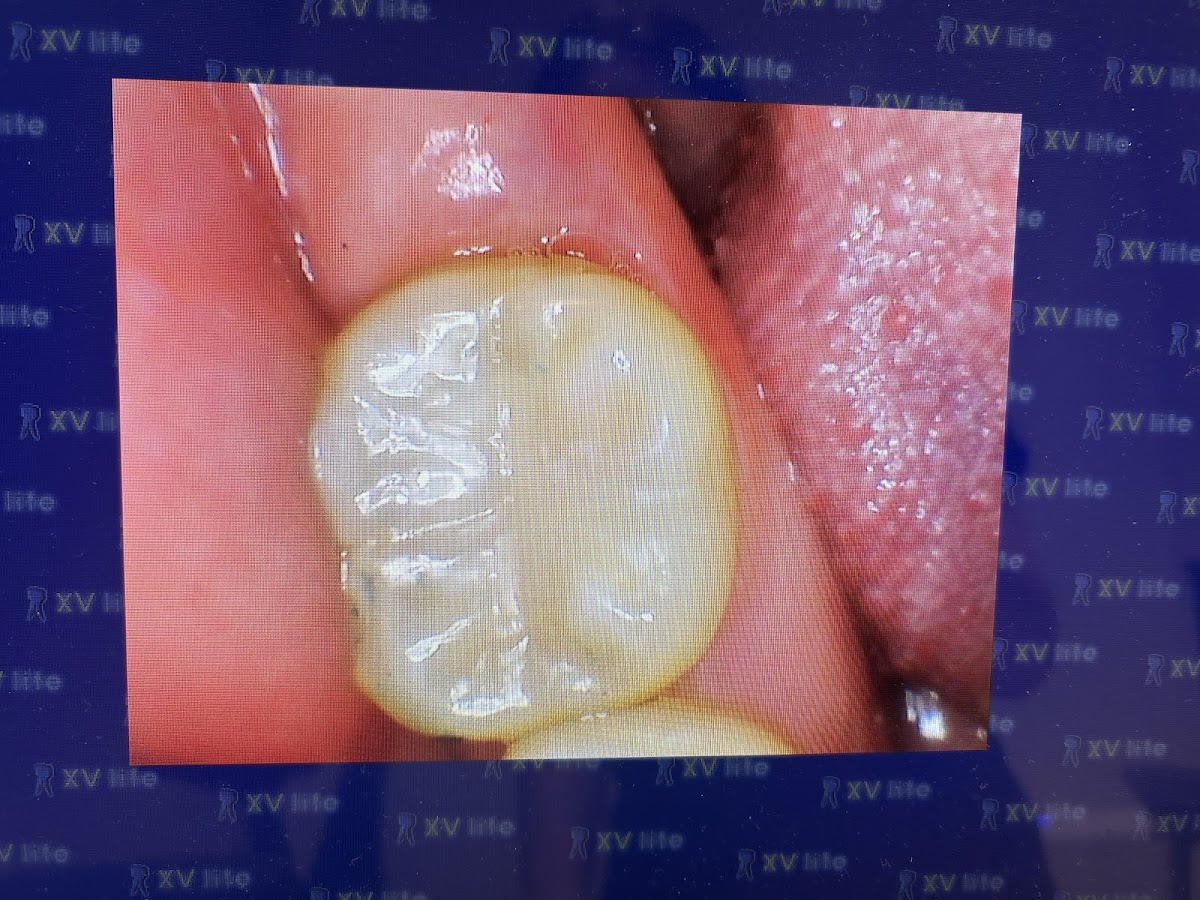 Brushwell Dental & Implants photo 5
