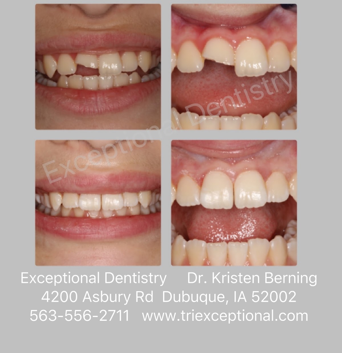 Exceptional Dentistry of the Tri-state Region photo 4