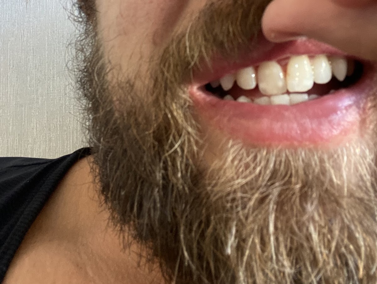 Dentart Chicago photo 6