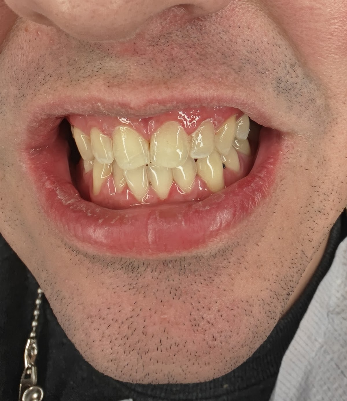 Smile N' Style Dental of Carmel photo 5