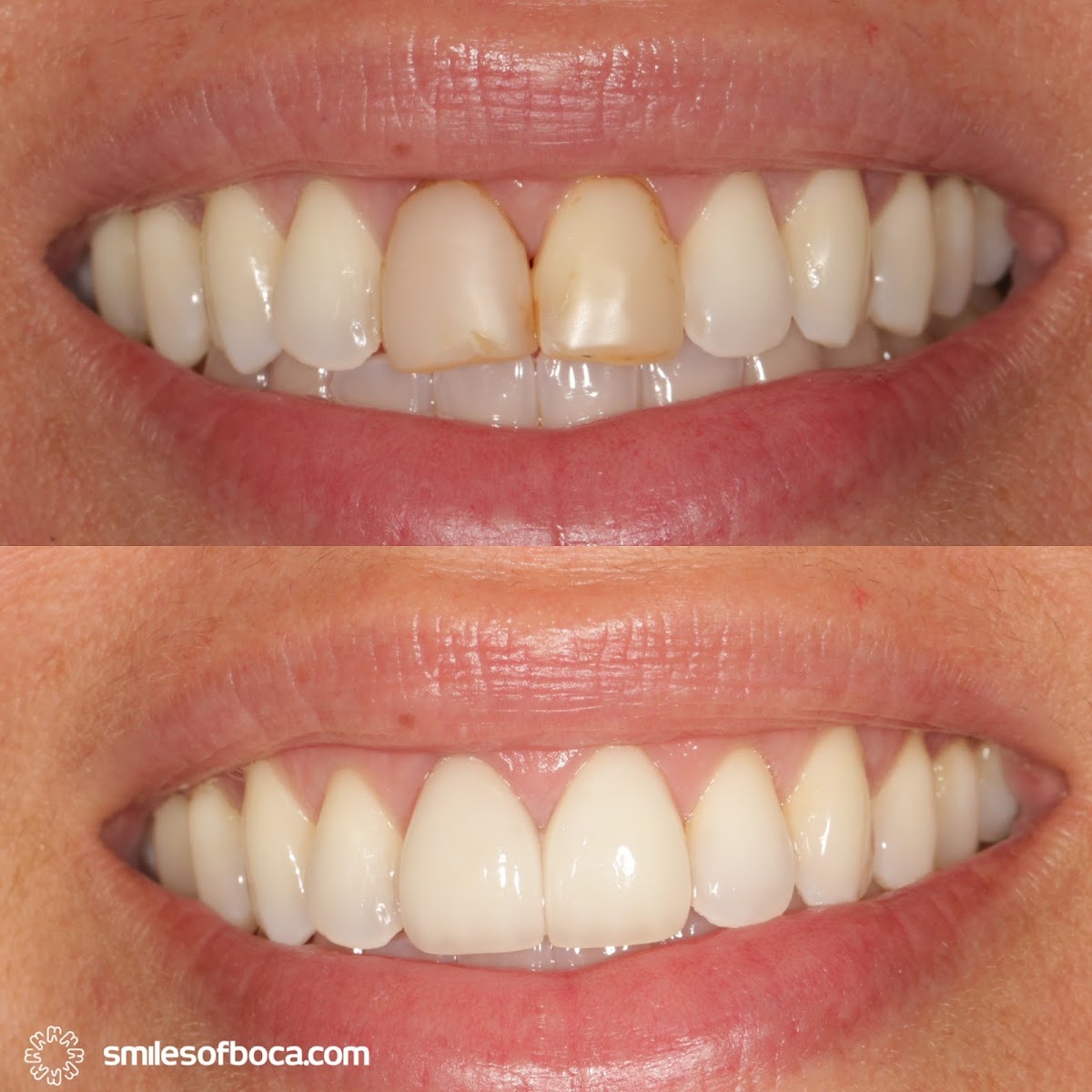 Smiles of Boca / Cosmetic Dentistry / Boca Raton photo 2