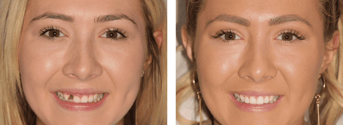Smiles of Boca / Cosmetic Dentistry / Boca Raton photo 5