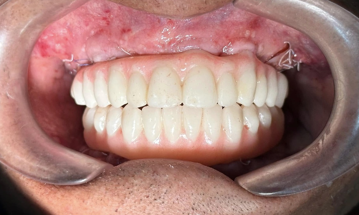 Bethlehem Dental Arts photo 4