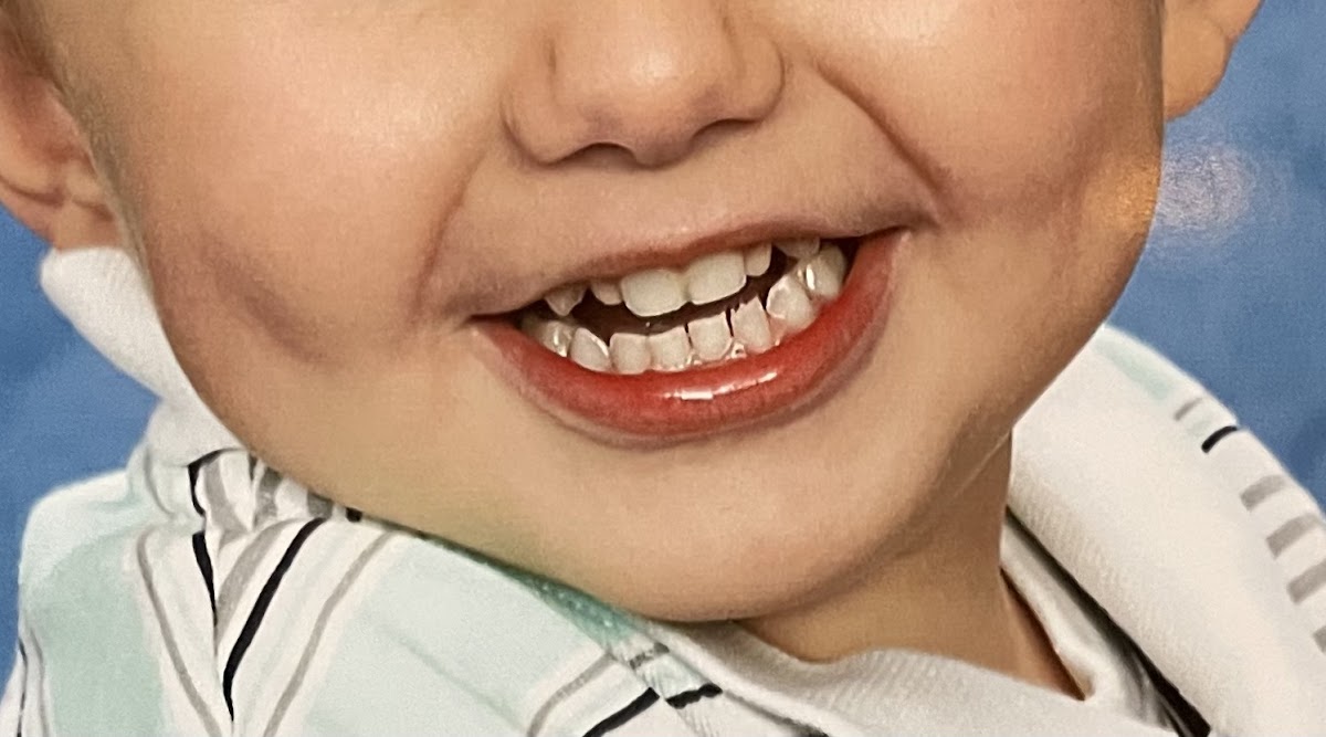 Troy Family Dental PLLC photo 3
