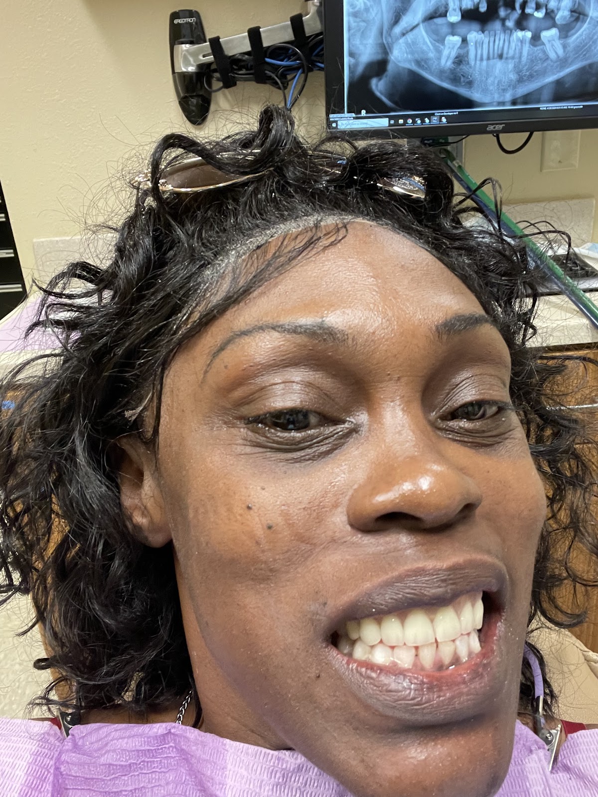 Affordable Dentures & Implants - Mccalla photo 2