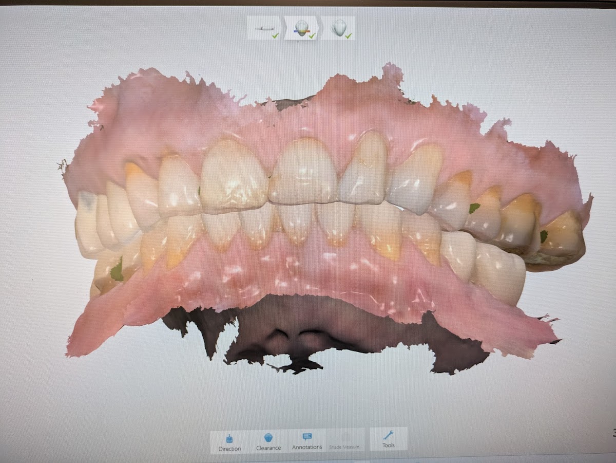 Aspen Dental - Hackettstown photo 2