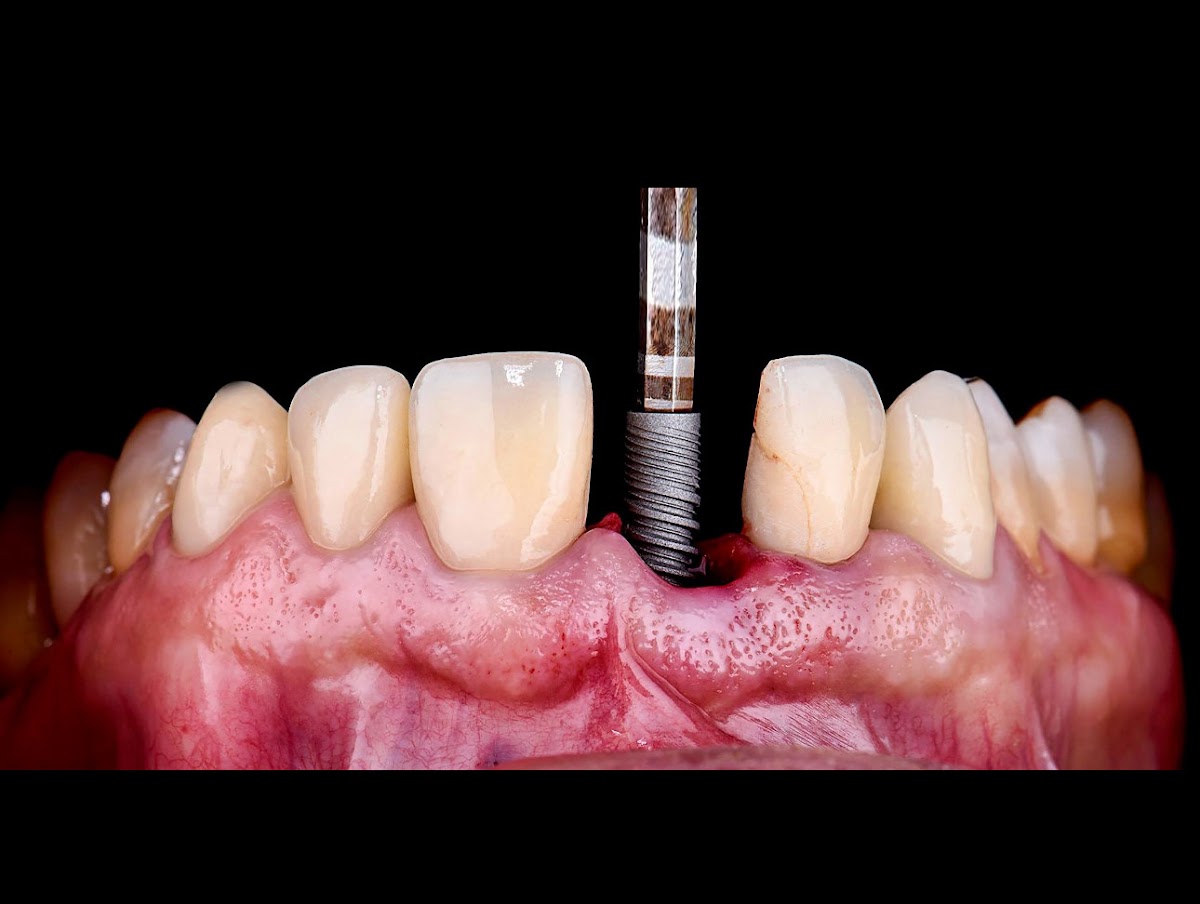 Eco Dental- He Harry Y DDS photo 2