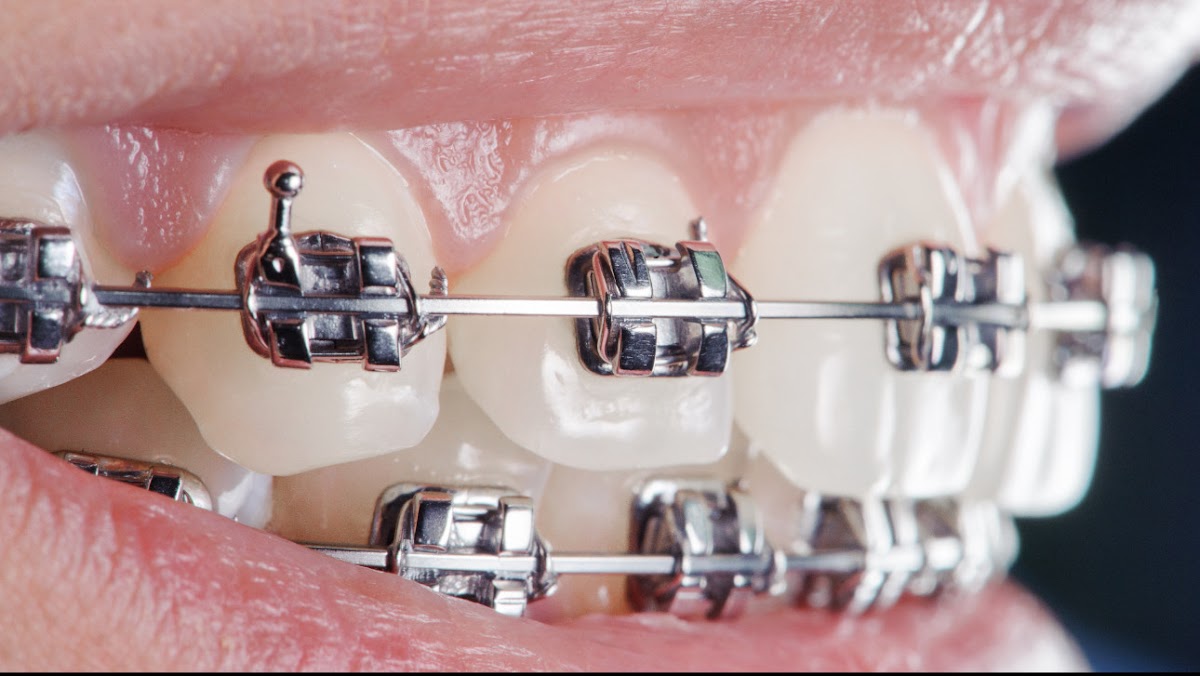 Eco Dental- He Harry Y DDS photo 6