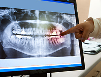 Mark Tickle DMD Family & Implant Dentistry photo 5