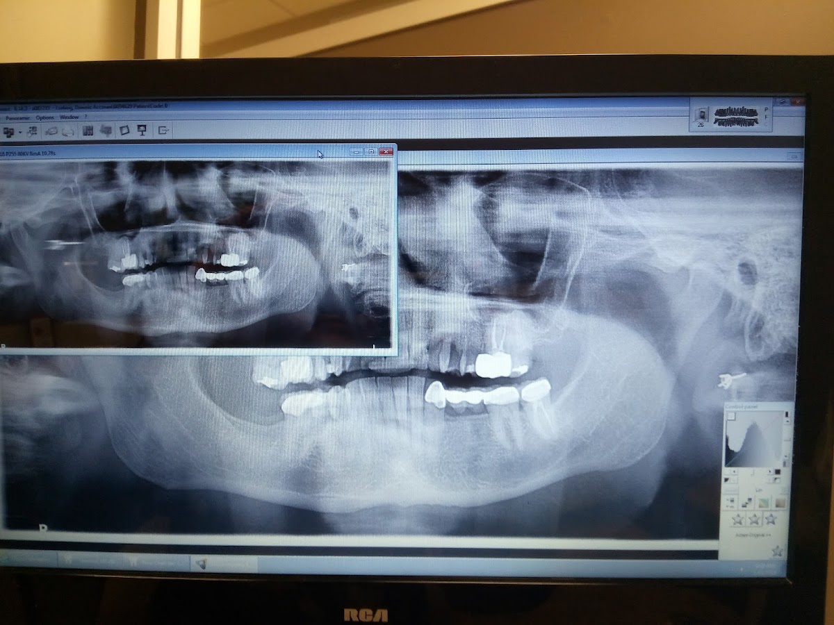 Aspen Dental - Flowood photo 2