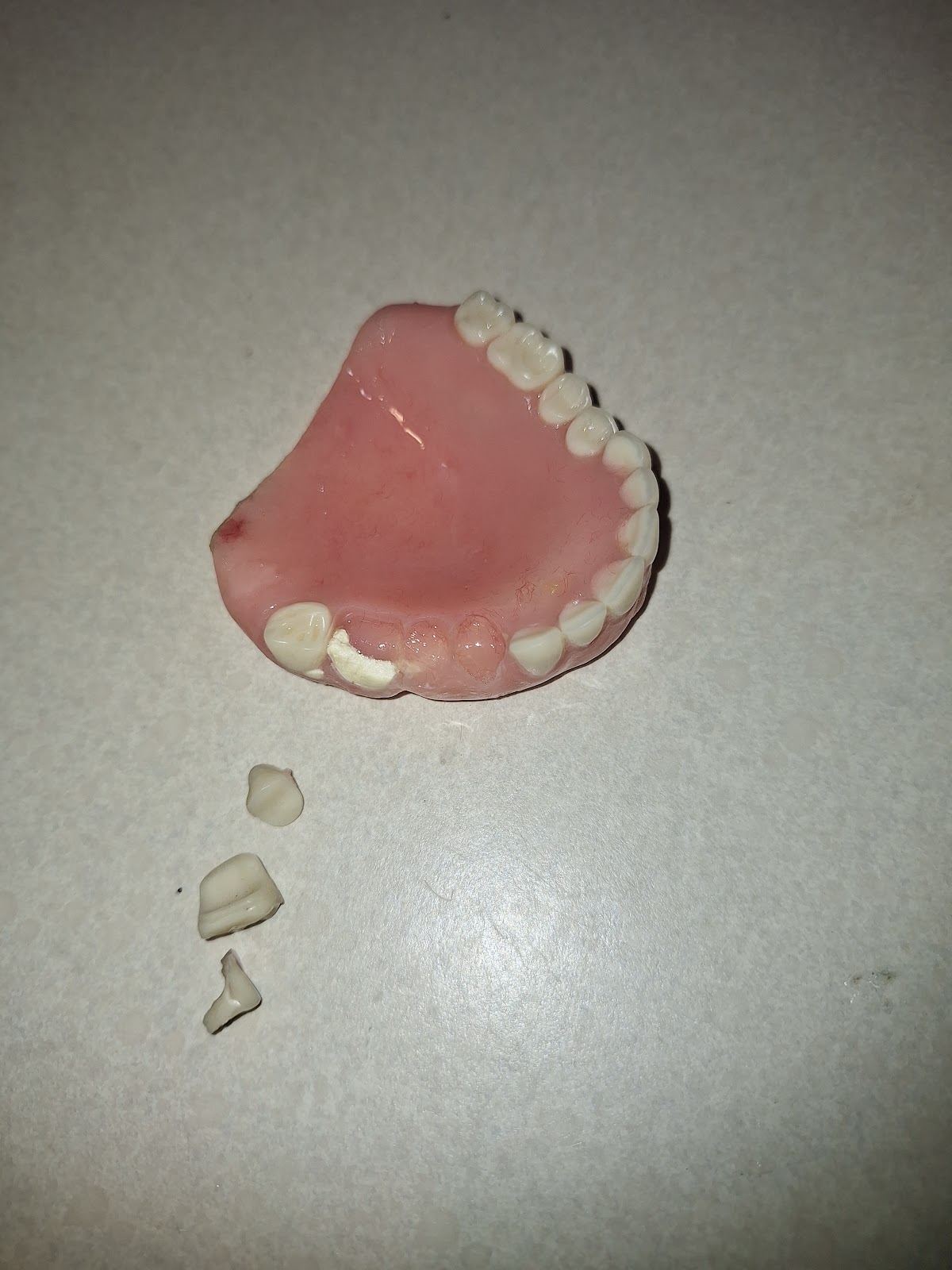 Aspen Dental - Texas City photo 6