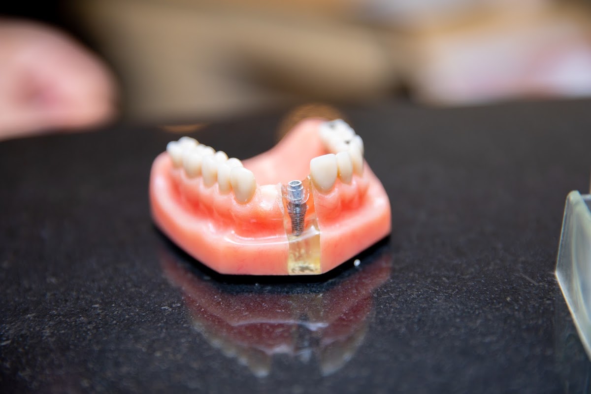 Periodontal Medicine & Surgical Specialists photo 2