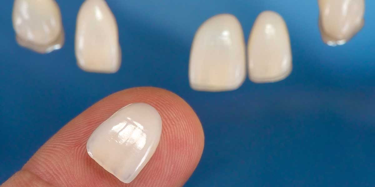 Stuart Prosthetic Dentistry photo 6