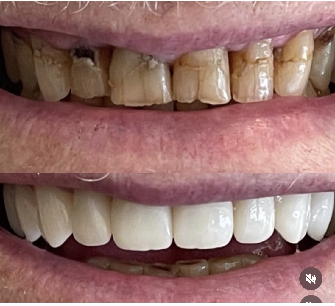 Shoal Creek Dental - Dr. Bruce Evans & Dr. Saul Evans photo 1
