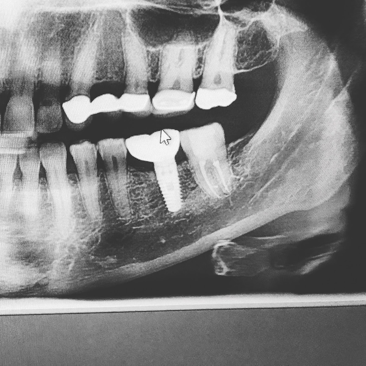 Shoal Creek Dental - Dr. Bruce Evans & Dr. Saul Evans photo 6