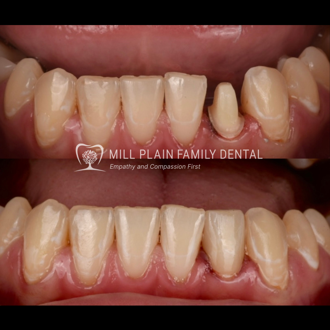 Mill Plain Family Dental photo 2