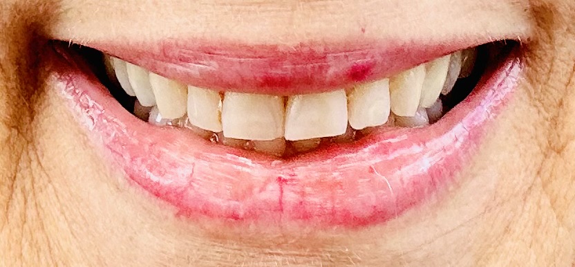 Mill Plain Family Dental photo 3