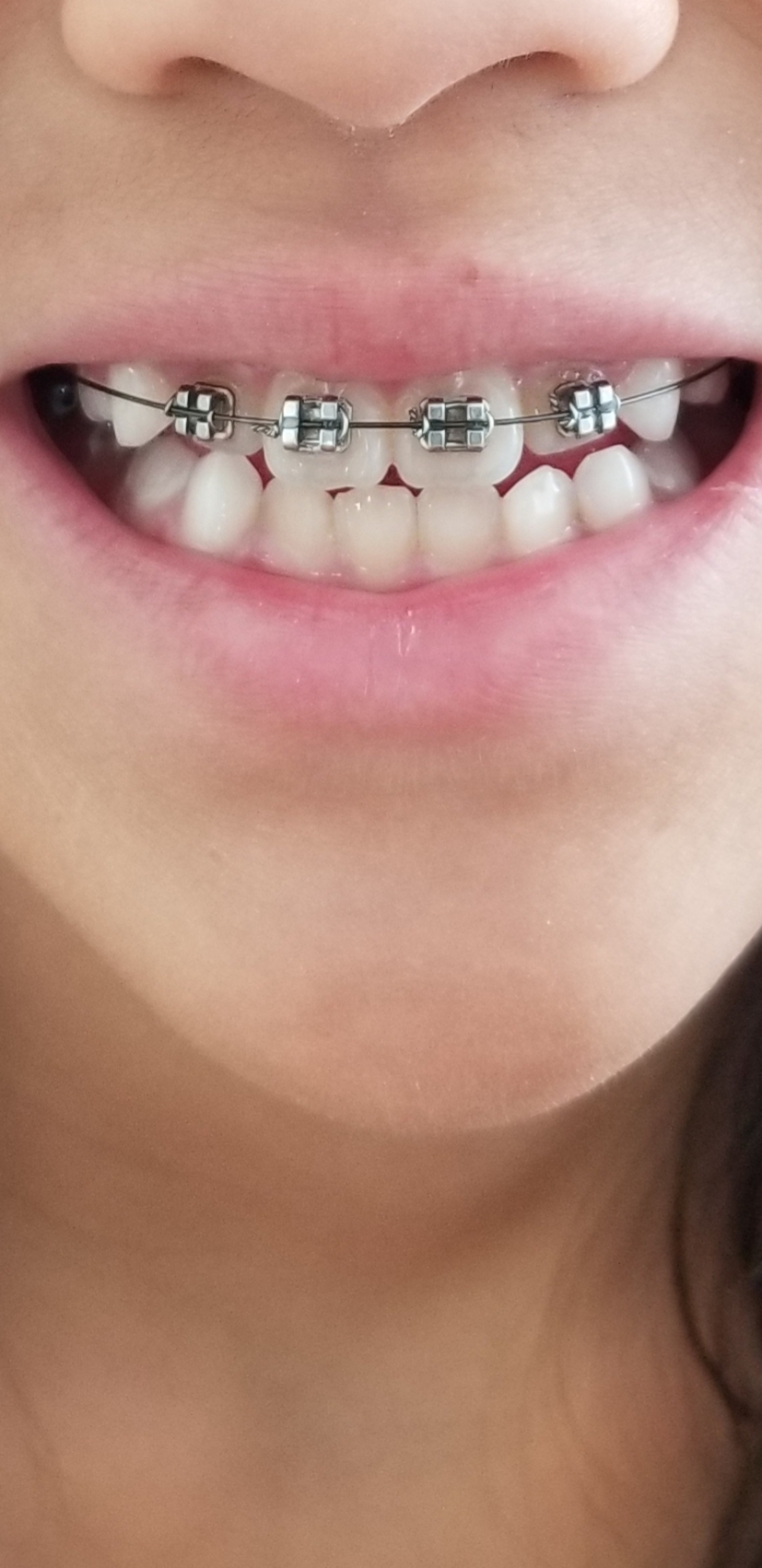 Functional Cosmetic Dentistry Associates photo 5