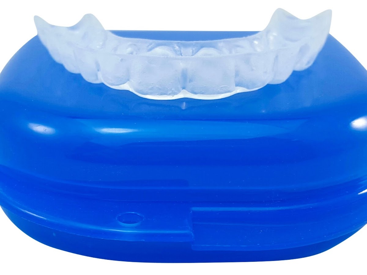 Teethnightguard.com Sparkling White Smiles Lab photo 4