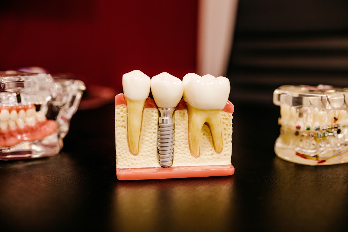 Boulevard Dental / Dentist In Palmdale photo 4